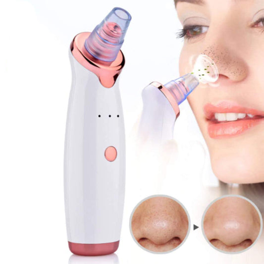 Acne Pimple Blackhead Remover Deep Cleaner fo Face- USB Charging_2