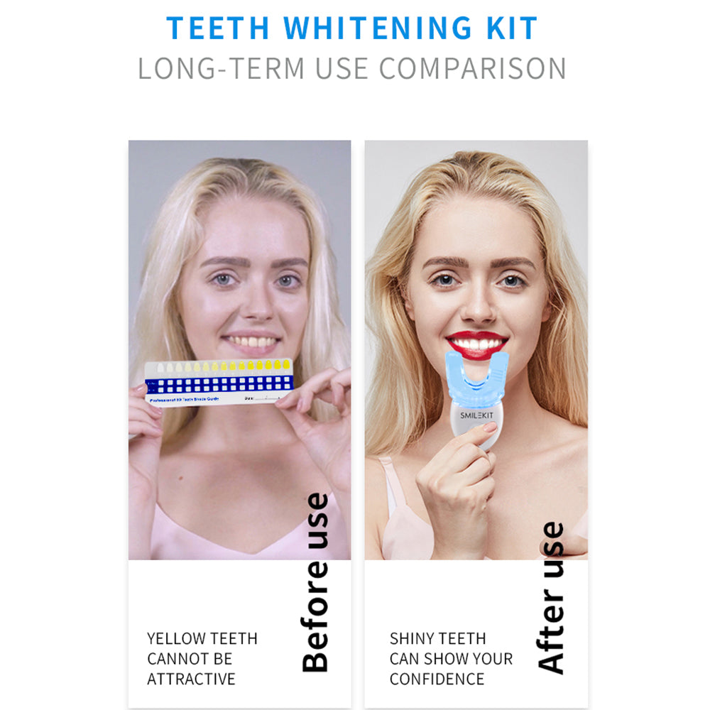Teeth Whitening Kit with LED Light Professional Cleaning Machine- Battery Operated_9