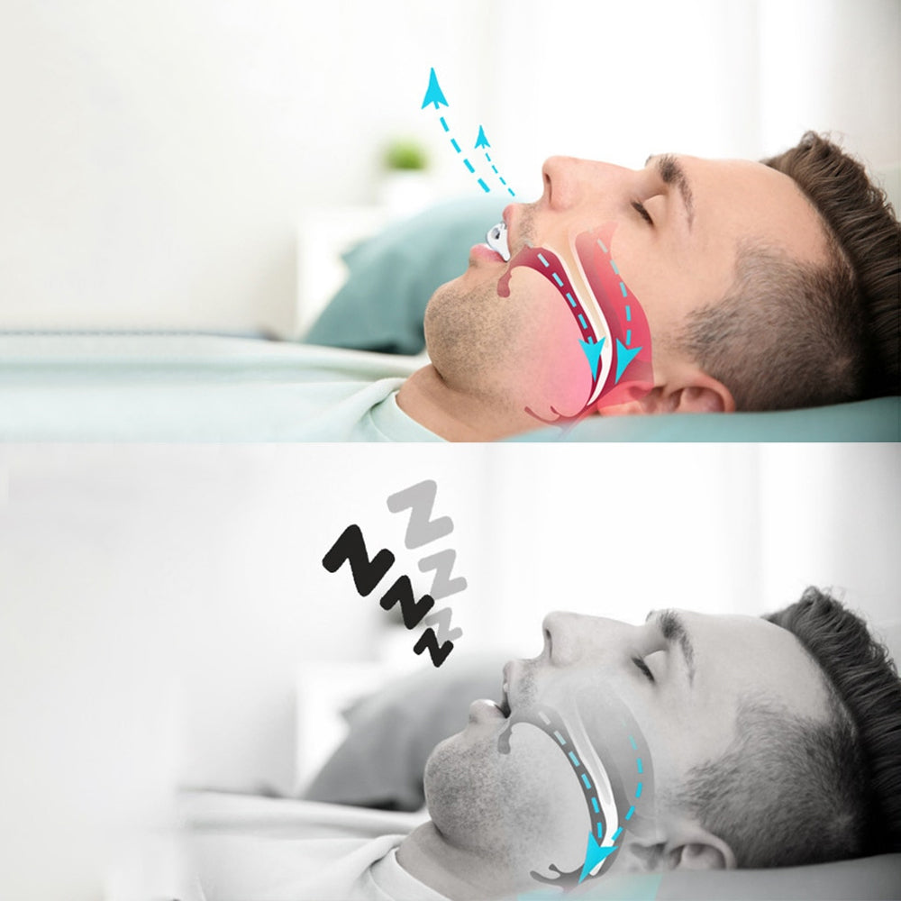 Anti-Snoring Corrective Breath Positioning Mouth Night Guard_11